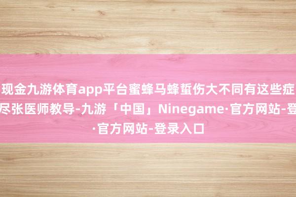 现金九游体育app平台蜜蜂马蜂蜇伤大不同有这些症状请详尽张医师教导-九游「中国」Ninegame·官方网站-登录入口